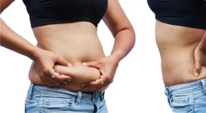 How to Get Rid of Excess Skin After Weight Loss?