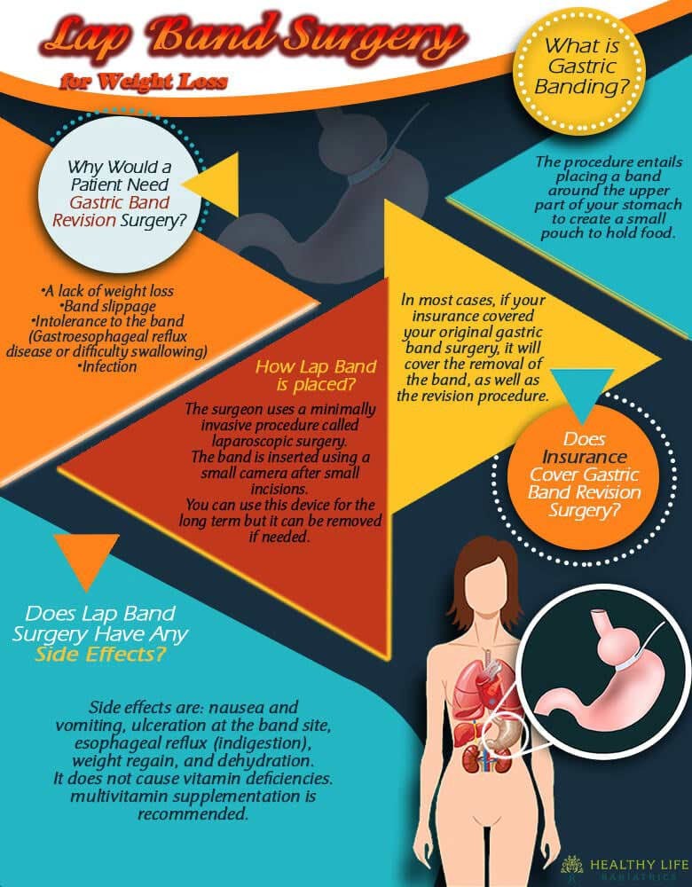 infographic Lap Band Surgery Los Angeles