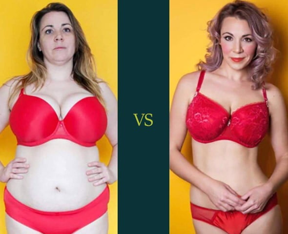 gastric bypass before and after women