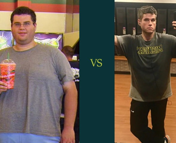 male gastric bypass before and after