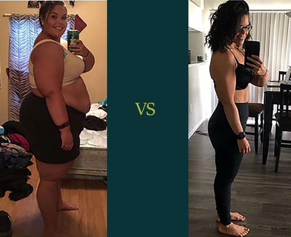 Vsg Weight Loss Before And After Blog Dandk 