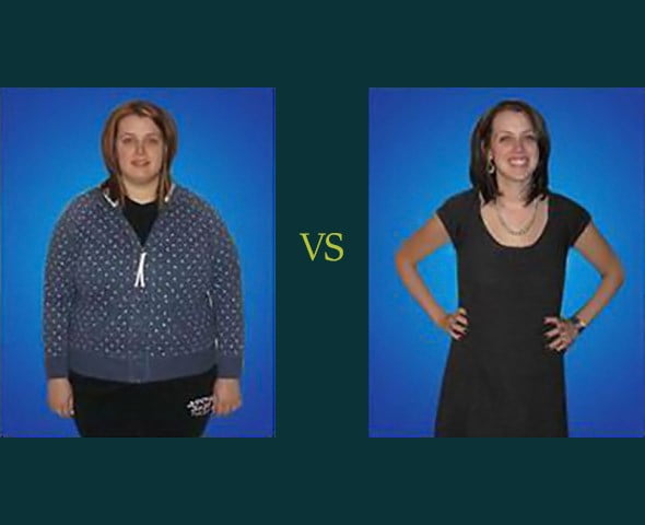 Marlee's Before and After Gastric Sleeve Surgery Photos & Story -  BeLiteWeight