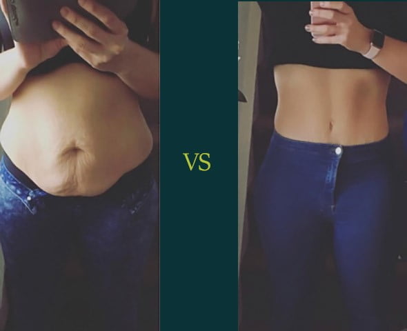 weight loss before and after stomach