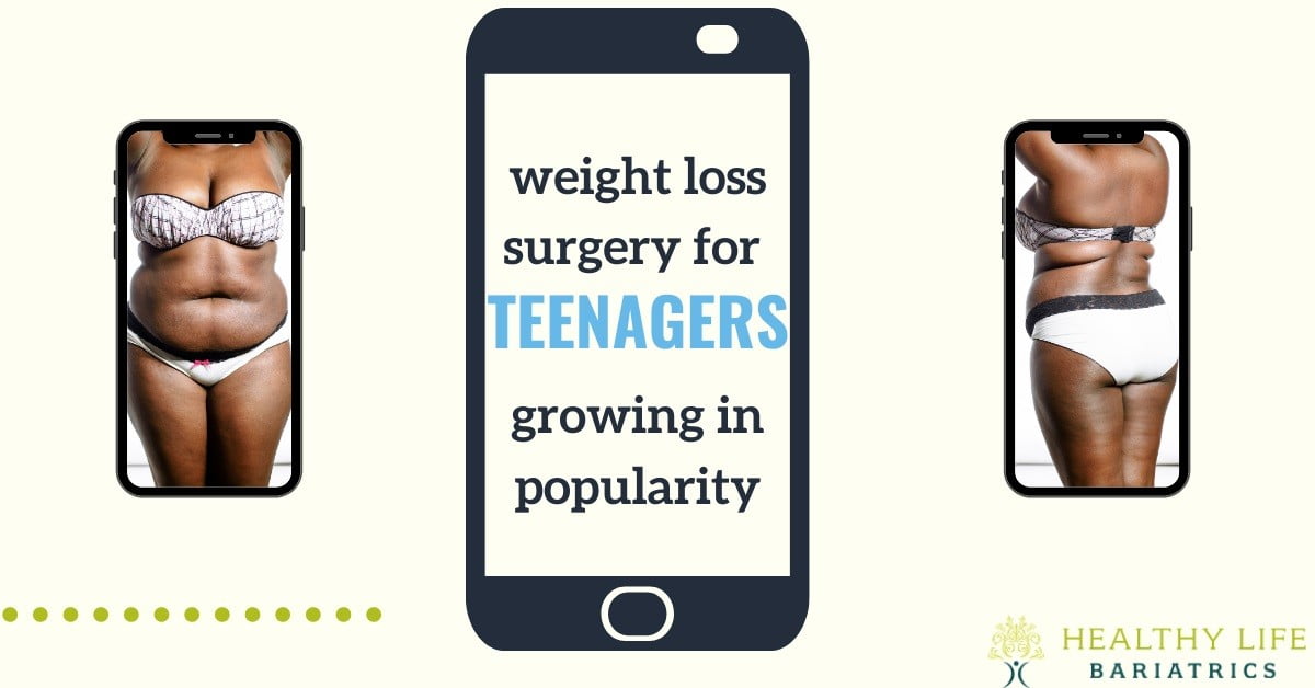 Weight loss surgery for teenagers growing in popularity.