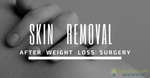 Skin Removal after Bariatric Surgery