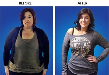 Two pictures of a woman before and after weight loss.