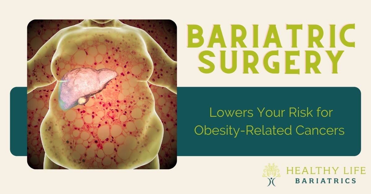 Bariatric surgery lowers your risk of obesity related cancers.