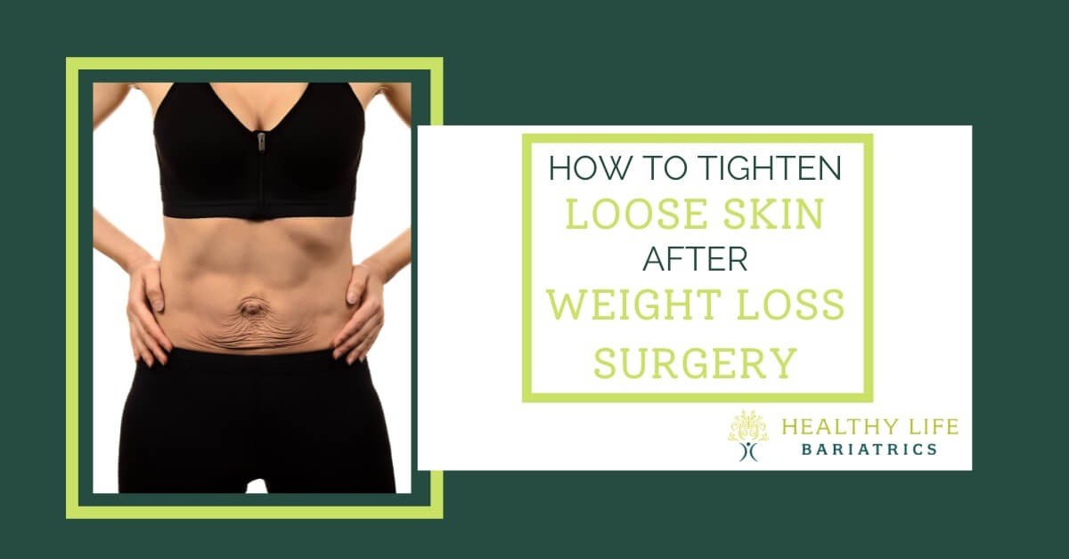 How To Tighten Loose Skin Without Surgery