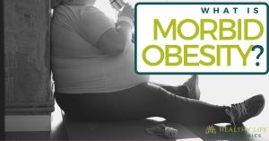 Morbid Obesity