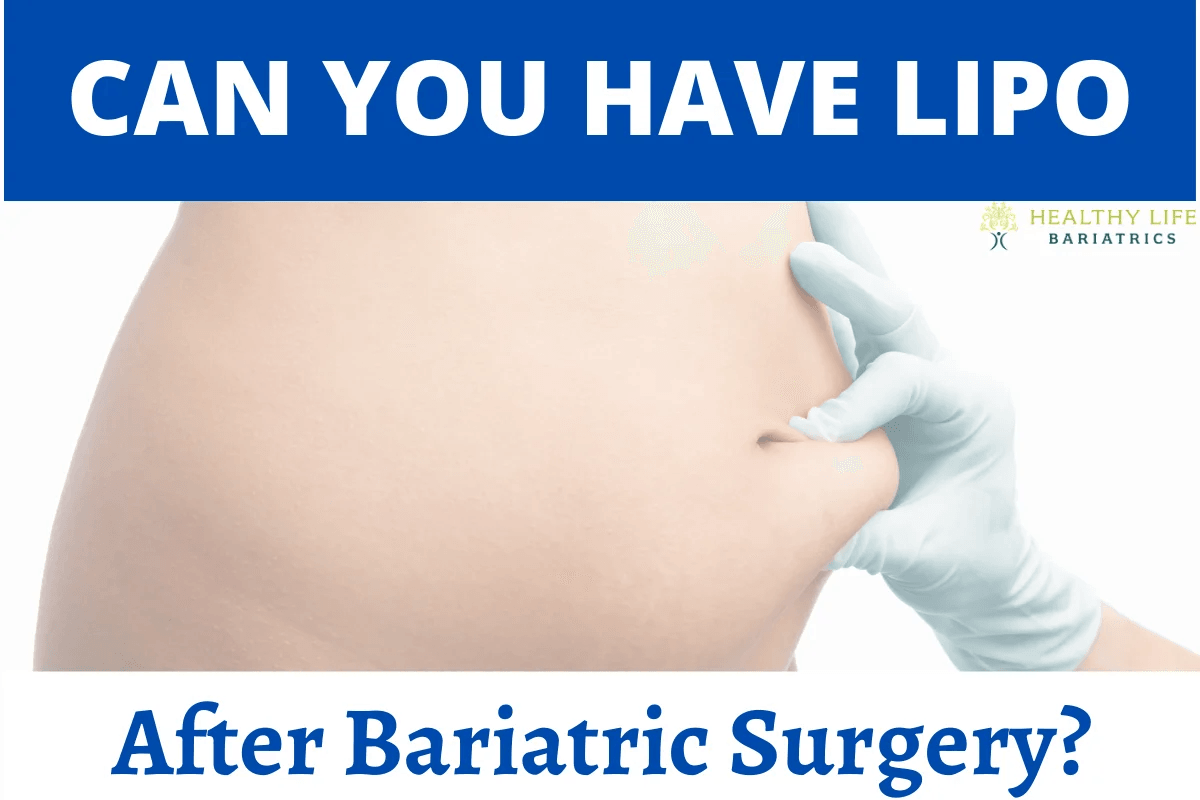 Post-bariatric Liposuction