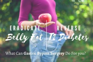 Can Gastric Bypass Reverse Diabetes in Los Angeles CA