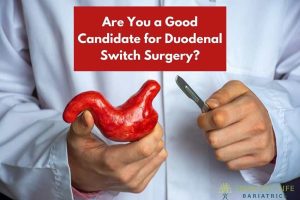 Are You a Candidate for Duodenal Switch Surgery?