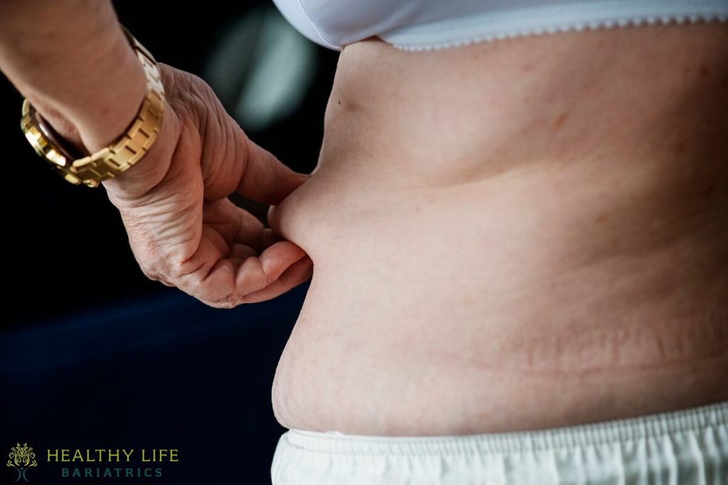 A woman's stomach with a white shirt on it.