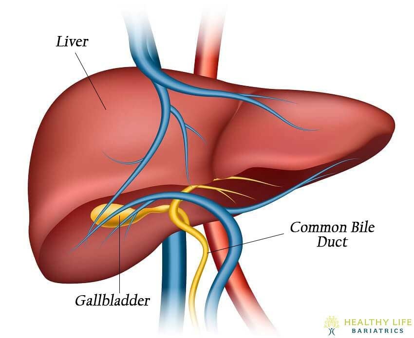 Gallbladder Surgery in Los Angeles CA