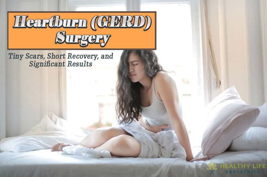 Heartburn (GERD) Surgery