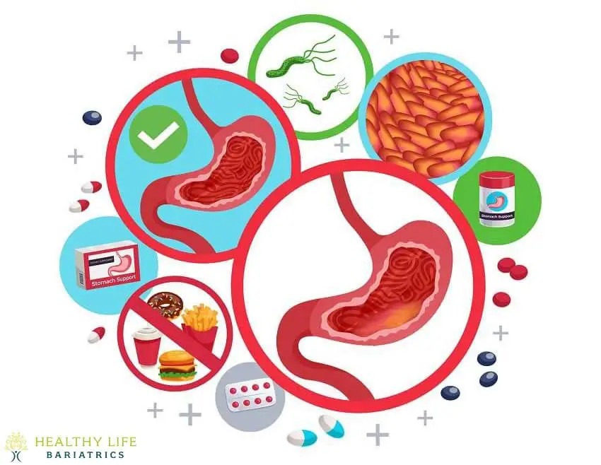 An illustration of a healthy stomach.