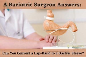 Gastric Banding to Gastric Sleeve in Los Angeles, CA