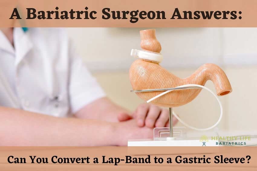 Gastric Banding to Gastric Sleeve in Los Angeles, CA