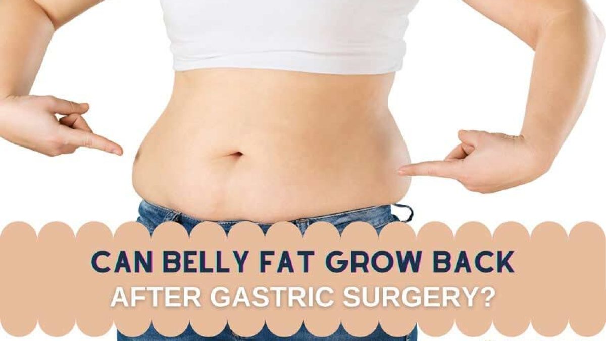 Can Belly Fat Return After Gastric Surgery? Los Angeles, CA | HLB