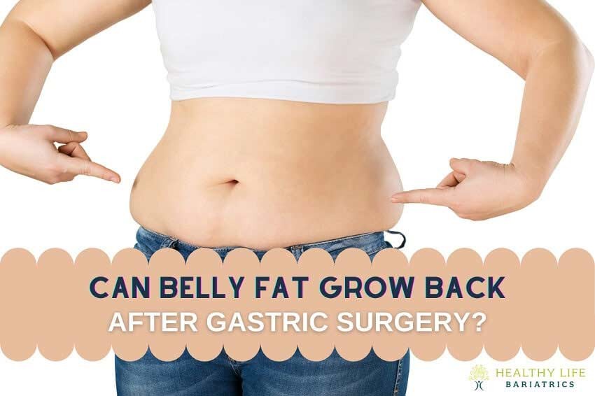 Can Belly Fat Return After Gastric Surgery? Los Angeles, CA