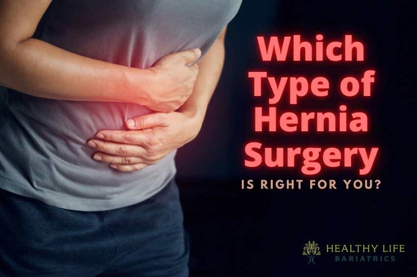 Different Types of Hernia Surgery