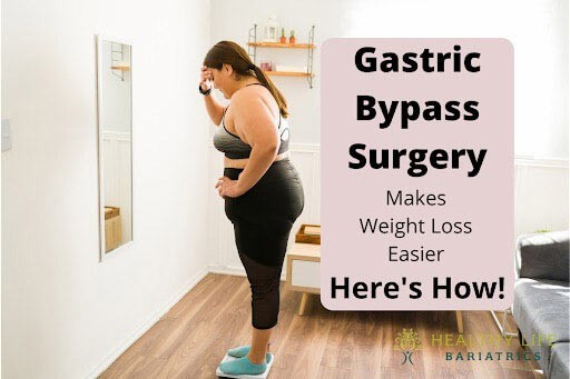 A woman standing in front of a mirror with the words gastric bypass surgery makes weight loss easier here's how.