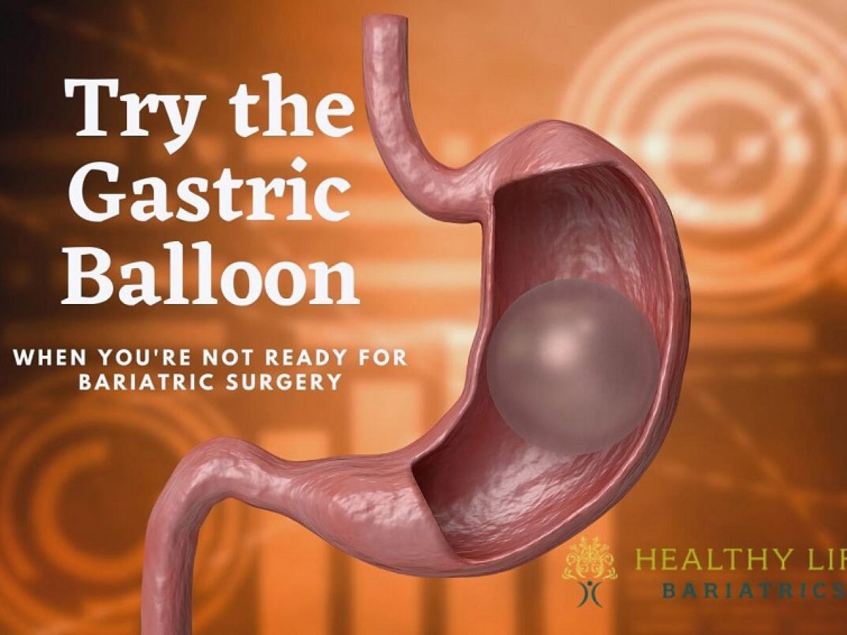 Gastric Balloon Surgery: Alternative to Bariatrics, Los Angeles, CA