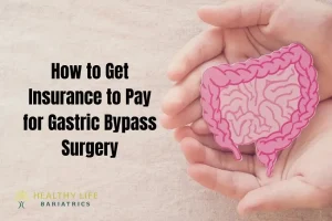 Insurance for Gastric Bypass Surgery LA, CA