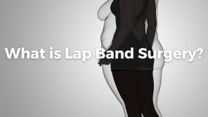 Lap band surgery