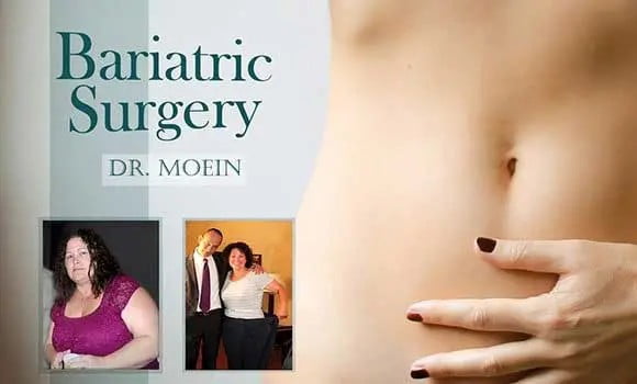 Bariatric surgery performed by Dr. Mohin specializing in weight loss surgery.