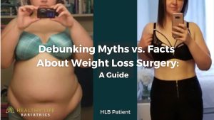 Debunking Myths vs Facts About Weight Loss Surgery