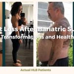 Weight Loss After Bariatric Surgery