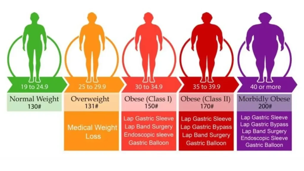 Do i qualify for gastric sleeve - BMI chart