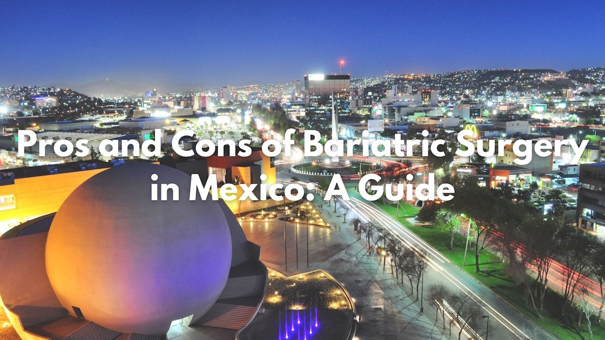 Pros and Cons of Bariatric Surgery in Mexico: A Guide