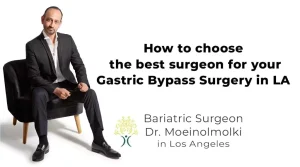 How to choose the Best surgeon for your Gastric Bypass Surgery LA, CA