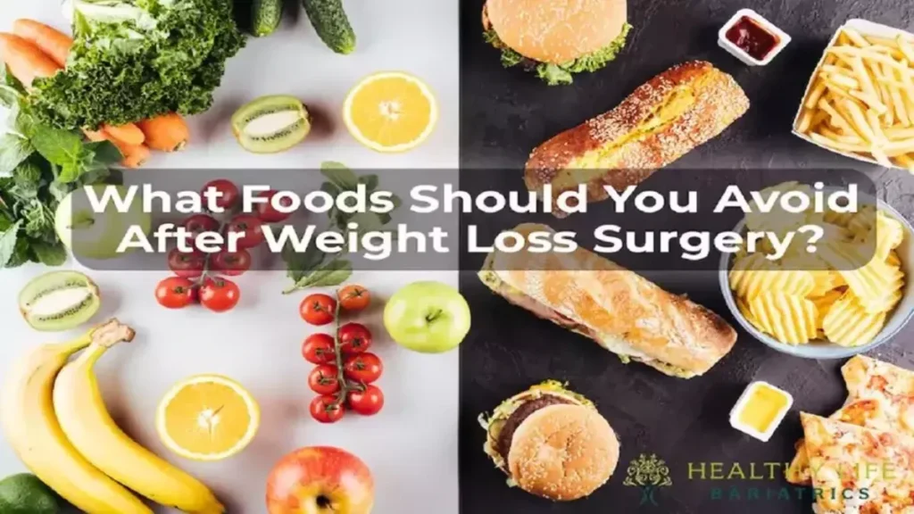 What foods should you avoid after weight loss surgery?.