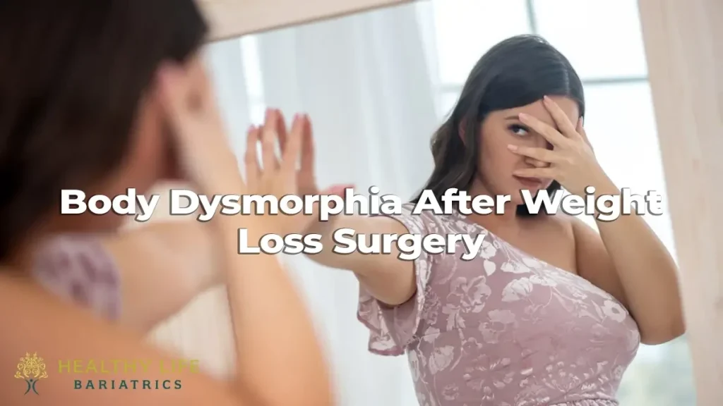 Body dysmorphia after weight loss surgery.