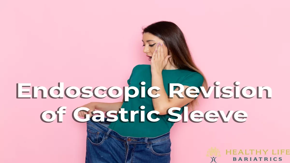 Endoscopic Revision of Gastric Sleeve