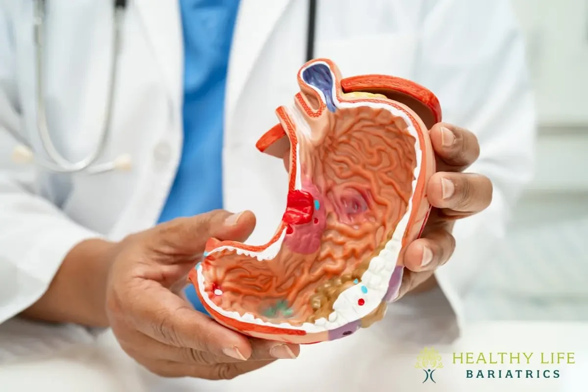 A doctor holding a model of a stomach.