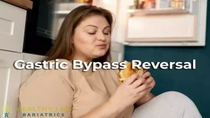 Gastric Bypass Reversal Los Angeles