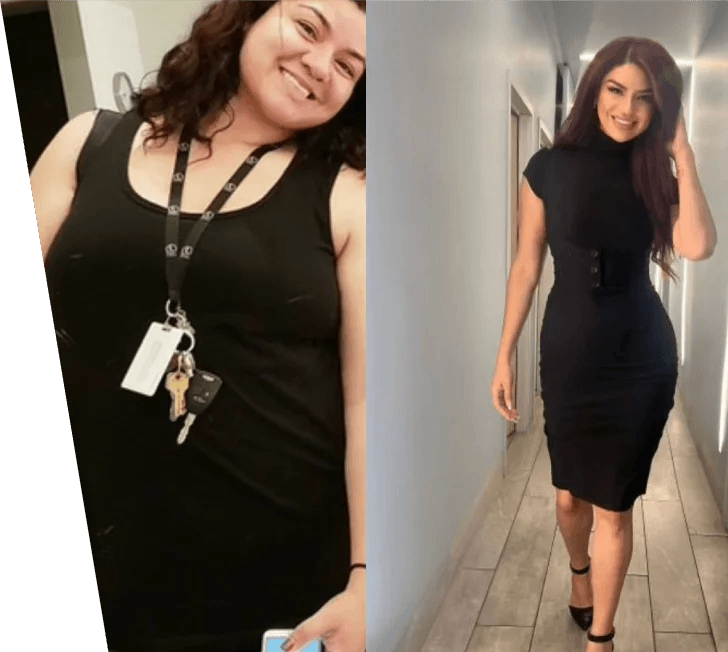 Two women posing in separate photos, both wearing black dresses and smiling, one with keys hanging around her neck, and the other with her hand on her hip after a weight loss surgery in Los Angeles.