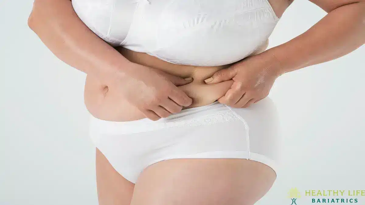 major complications after gastric sleeve in LA, CA