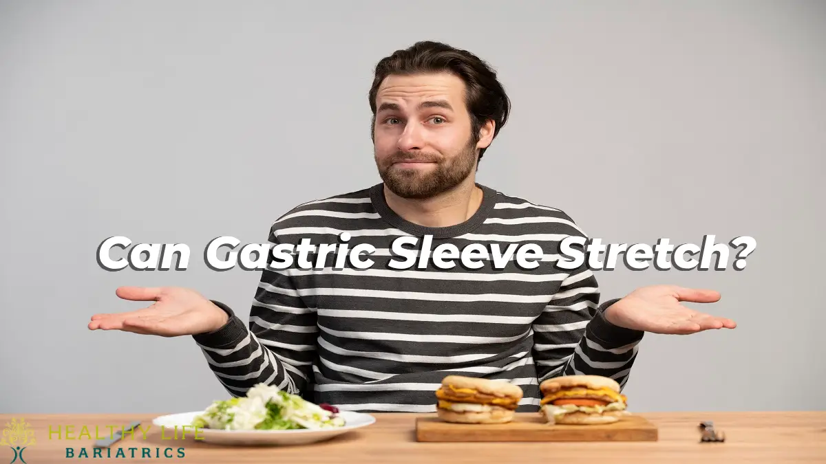 Can Gastric Sleeve Stretch?