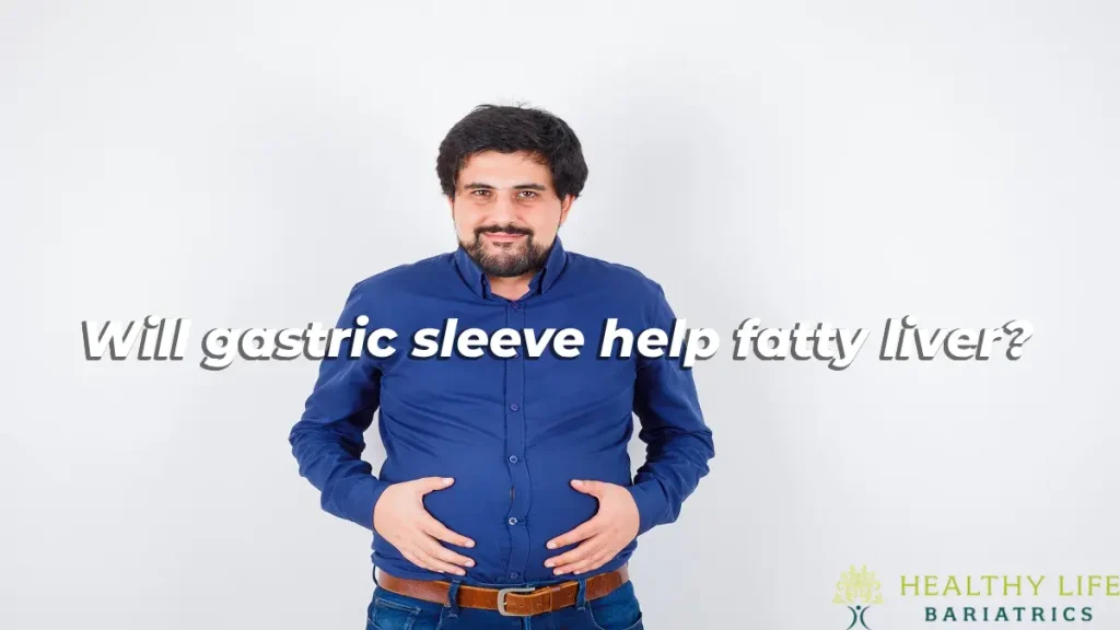 Can Gastric Sleeve Help Fatty Liver in LA, CA