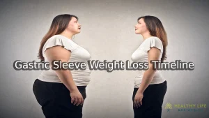 Gastric Sleeve Weight Loss Timeline in Los Angeles, CA