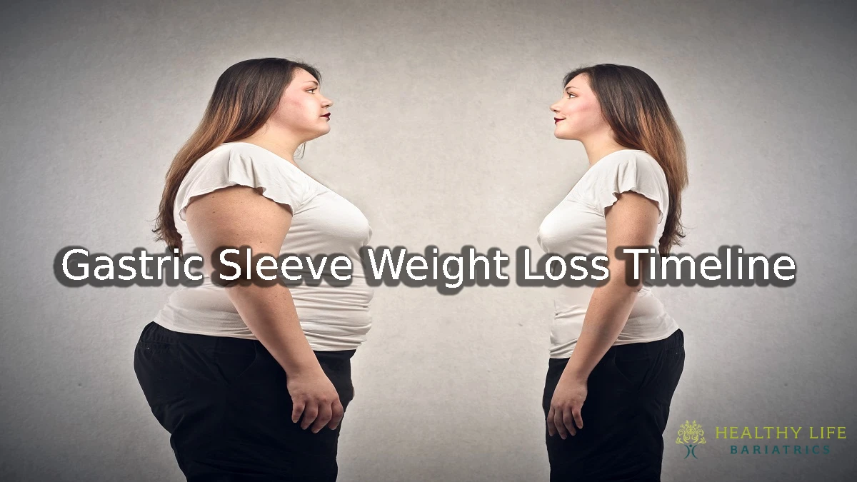 Gastric Sleeve Weight Loss Timeline