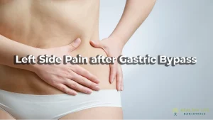 Left Side Pain after Gastric Bypass in LA