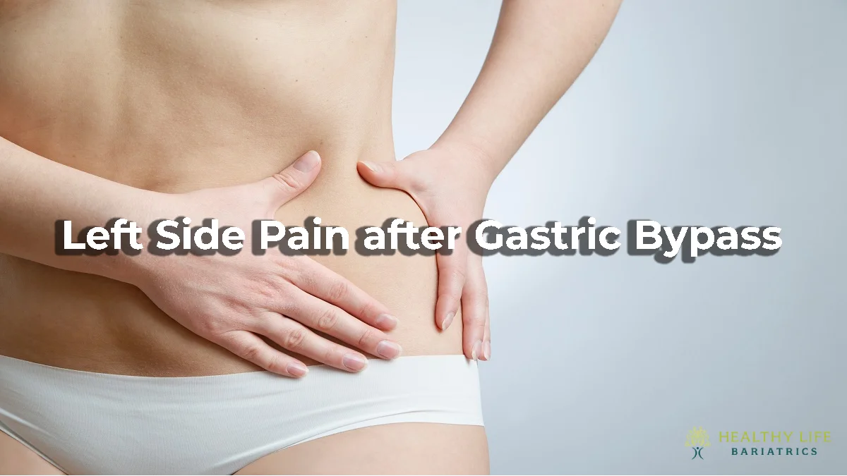 Left Side Pain after Gastric Bypass