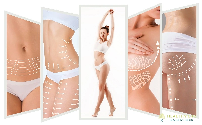 Combining a Breast Lift with Other Procedures Combining a Breast Lift with Other Procedures