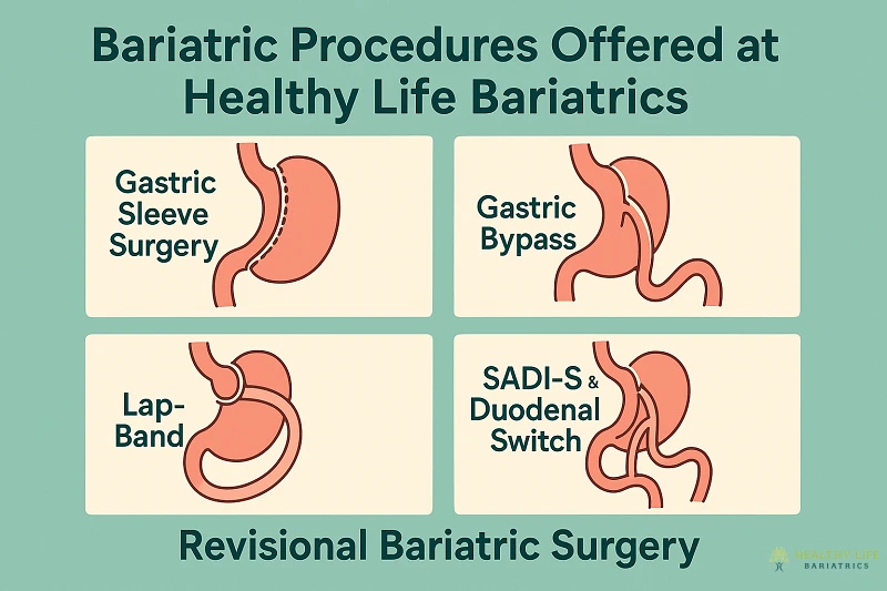 Bariatric Procedures Offered at Healthy Life Bariatrics in Los Angeles Bariatric Procedures Offered at Healthy Life Bariatrics in Los Angeles